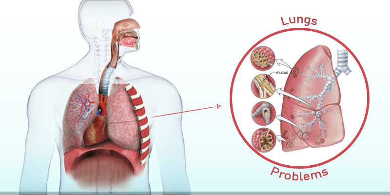 Lungs-Problem-Creative