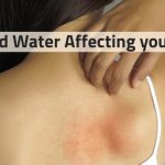 How to protect your skin from hard water