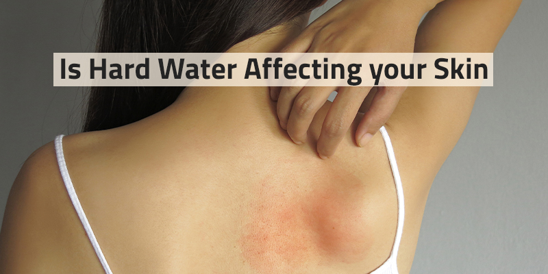 How to protect your skin from hard water