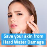 Prevent these Skin Problems by Softening Hard Water with Kent Water Softener