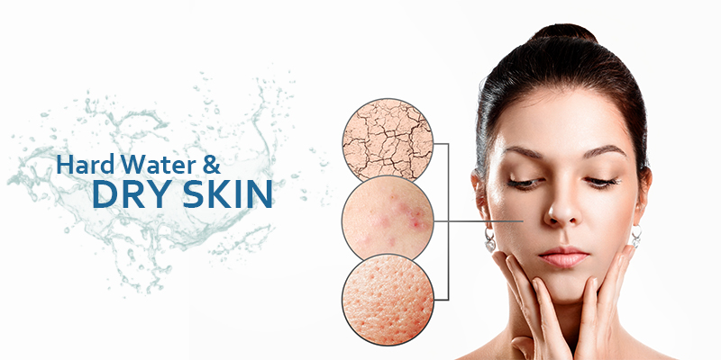 How does hard water make your skin dry?