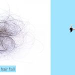 Hard-water-and-hair-fall