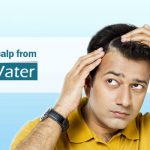 Hard water and dry scalp during winter