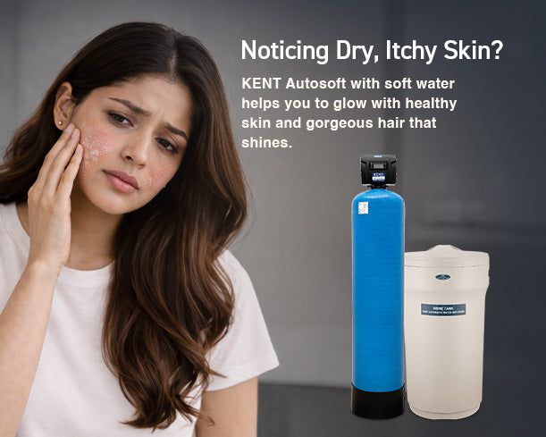 Kent Automatic Water Softener 100L system with digital control and resin tank for softening hard water.